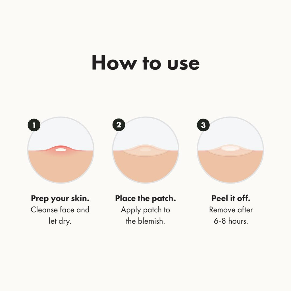 Mighty Patch™ Original patch from Hero Cosmetics – The #1 Hydrocolloid Acne Pimple Patch for Shrinking Zits and Whiteheads in 1 use; Nighttime Spot Stickers for Face and Skin (36 Count)