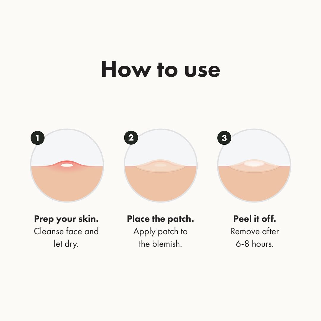 Mighty Patch™ Original patch from Hero Cosmetics – The #1 Hydrocolloid Acne Pimple Patch for Shrinking Zits and Whiteheads in 1 use; Nighttime Spot Stickers for Face and Skin (72 Count)