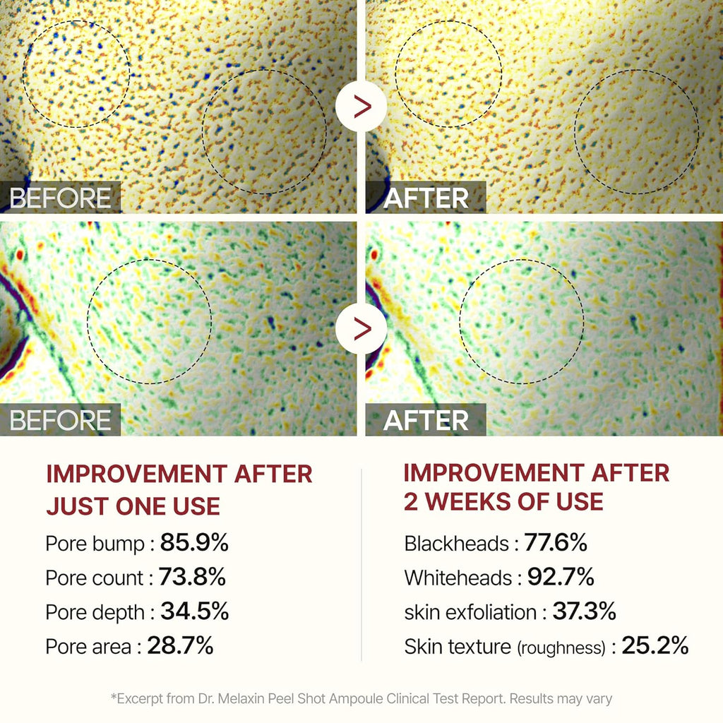 Peel Shot Glow Rice Peeling Ampoule, Soft Exfoliating Face and Body Scrub Dead Skin Cells Remover for All Skin Types korean skin care 80ml (BLACK RICE)