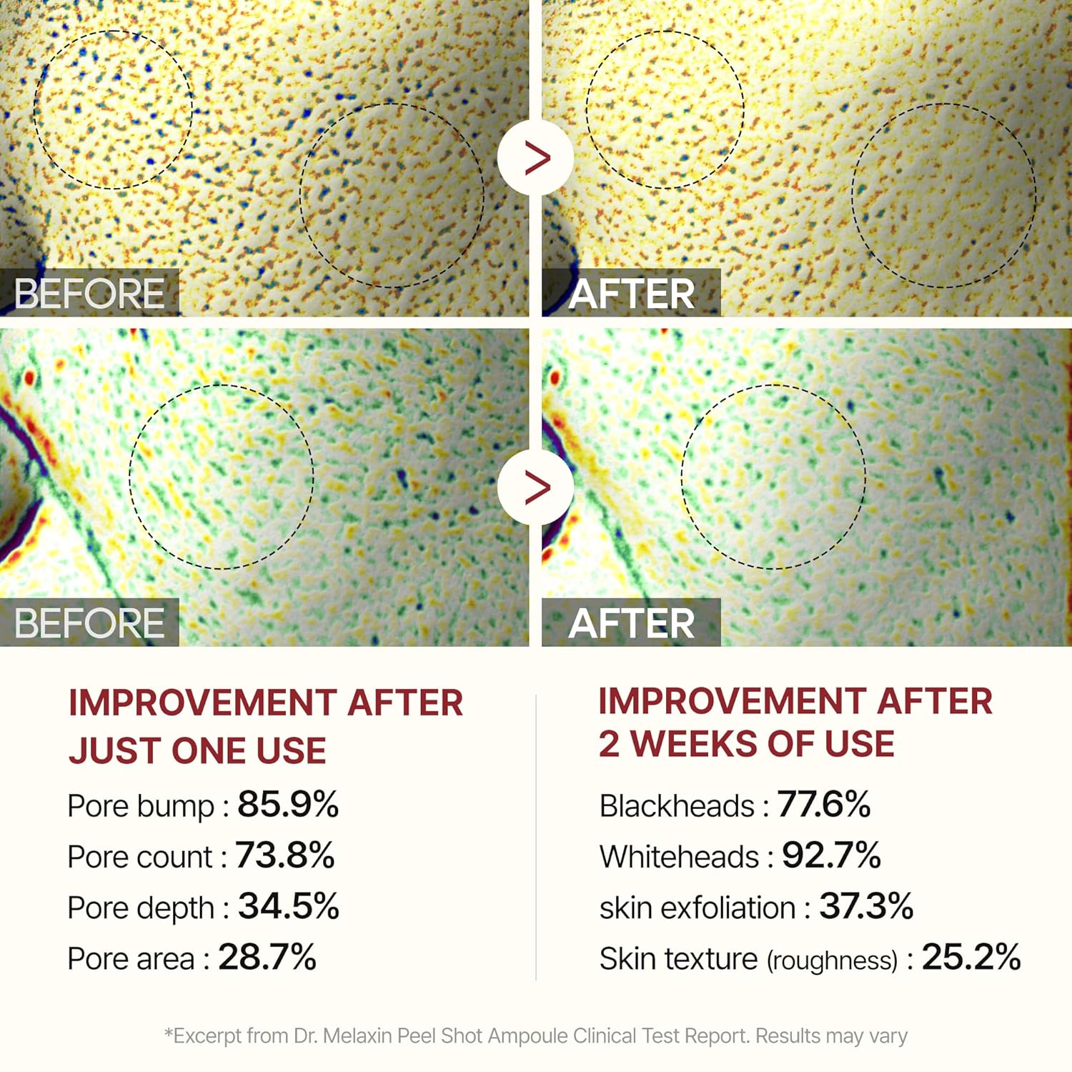 Peel Shot Glow Rice Peeling Ampoule, Soft Exfoliating Face and Body Scrub Dead Skin Cells Remover for All Skin Types korean skin care 80ml (BLACK RICE)