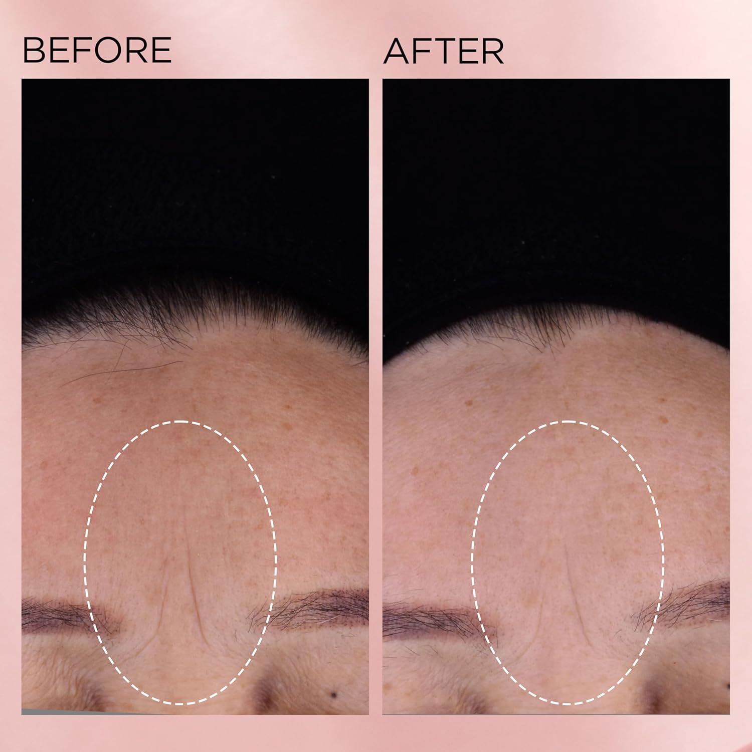 Elizabeth Arden Retinol + HPR Ceramide Rapid Skin Renewing Anti-Aging Face Serum Capsules, Fine Lines & Wrinkles Treatment with Peptides, Vitamin E, & Niacinamide