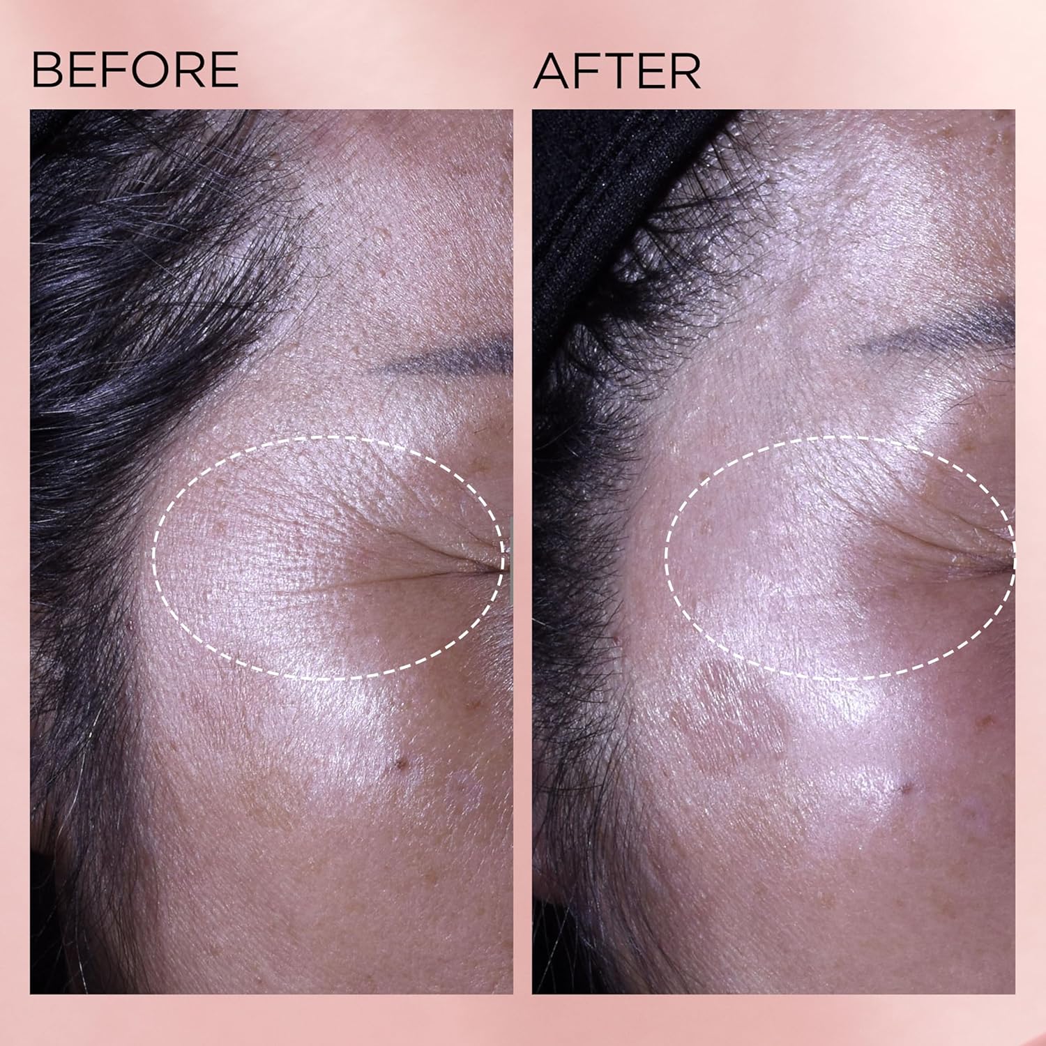 Elizabeth Arden Retinol + HPR Ceramide Rapid Skin Renewing Anti-Aging Face Serum Capsules, Fine Lines & Wrinkles Treatment with Peptides, Vitamin E, & Niacinamide